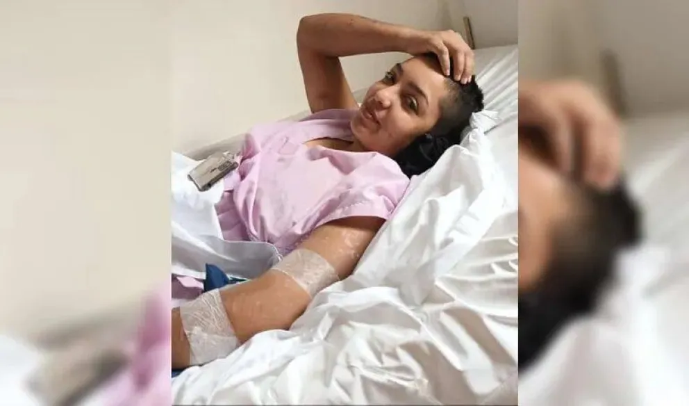 La joven brutalmente atacada por una jauría fue sometida a una operación por infecciones 