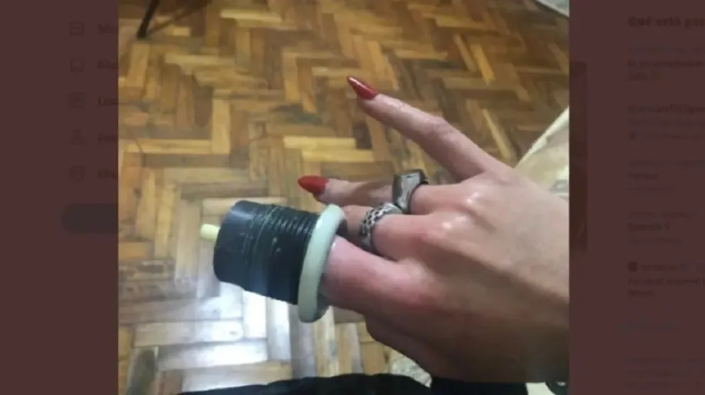 Fue al baño y se le quedó su dedo atrapado en la mochila del inodoro
