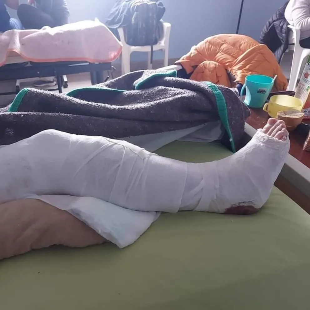 Le destrozaron la pierna para robarle y ahora junta dinero para pagar su operación 
