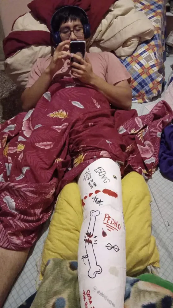 Rifa solidaria: sufrió un accidente en moto y necesita juntar 500 mil pesos para operarse