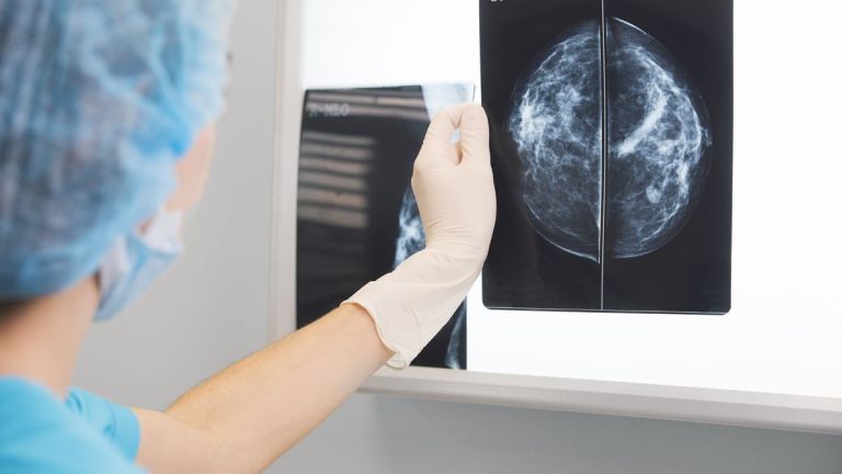 Suman 50 mamografías más a la Campaña Octubre Rosa en Roca