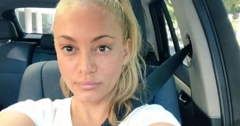 Impactante transformación: El nuevo rostro de María Eugenia Ritó tras un revolucionario tratamiento estético