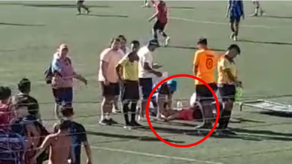 Un nene se fracturó la pierna en el Mundialito y otra vez no había ambulancia