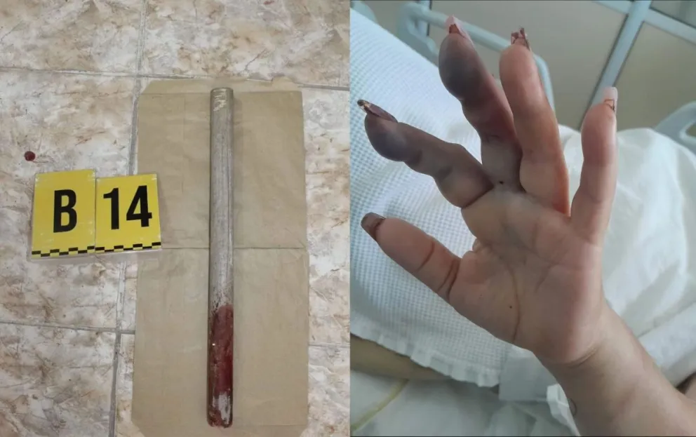 Intento de femicidio: Golpeó a su expareja con un palo y la dejó inconsciente en el patio de la casa