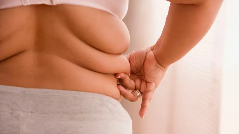 La obesidad en Argentina: una epidemia que afecta a 1 de cada 4 personas