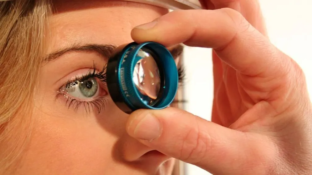 Glaucoma: la primera causa de ceguera prevenible en el mundo