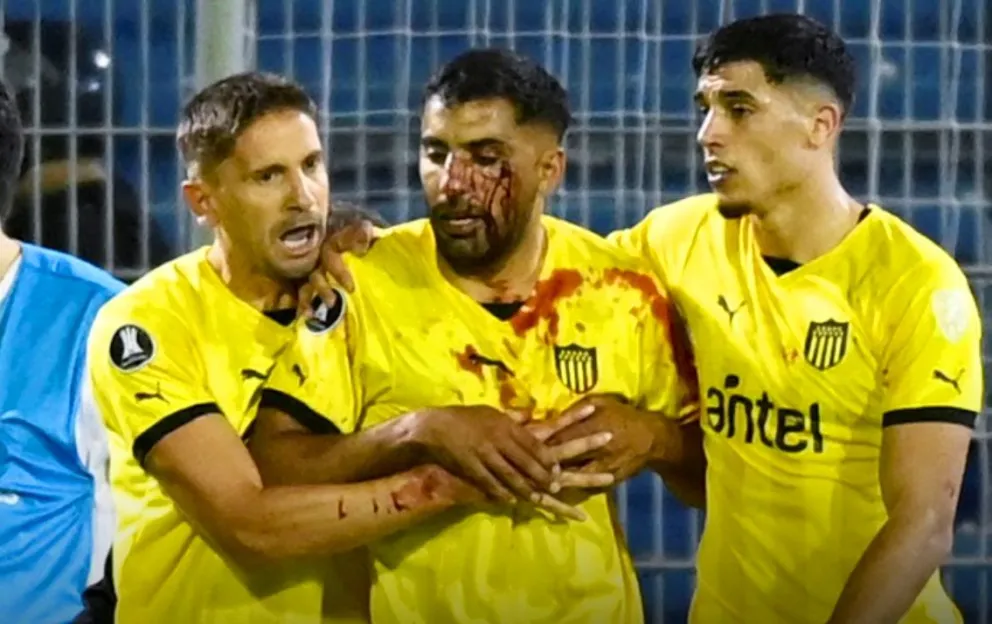 Rosario Central podría recibir una dura sanción por los incidentes ante Peñarol