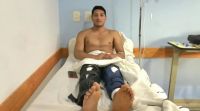 Insólito: fue a hacerse una cirugía en la rodilla y por error le operaron las dos piernas