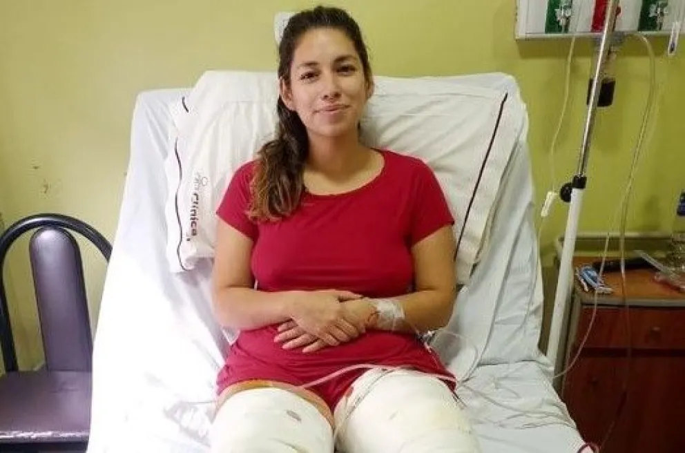 Todos por Emi: Sufrió un accidente laboral y está recaudando fondos para su tratamiento
