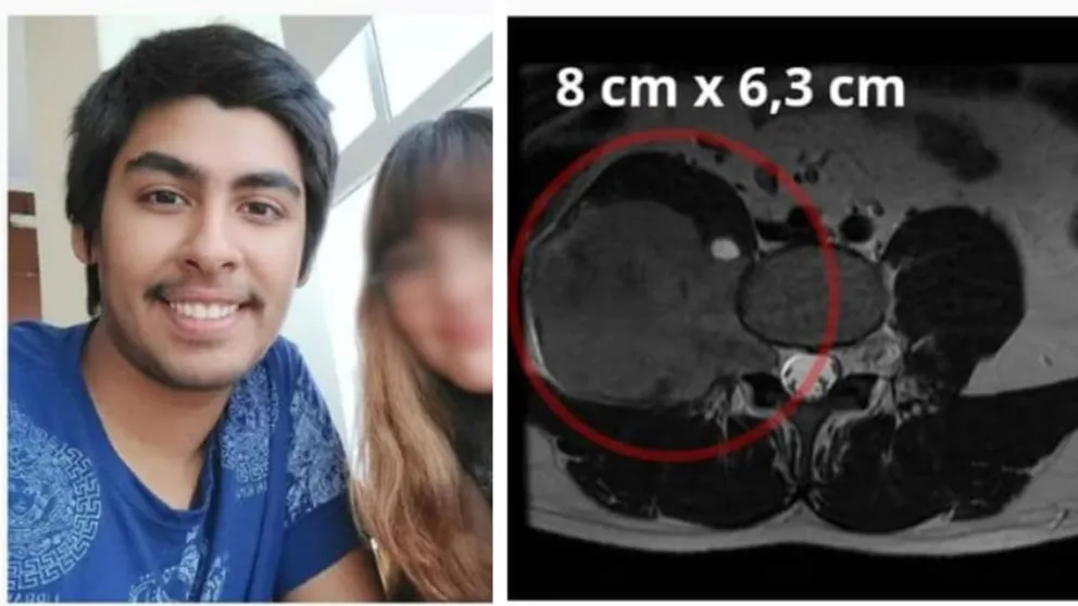 Roca: tiene un tumor en la columna y su madre sortea viajes para costear la operación