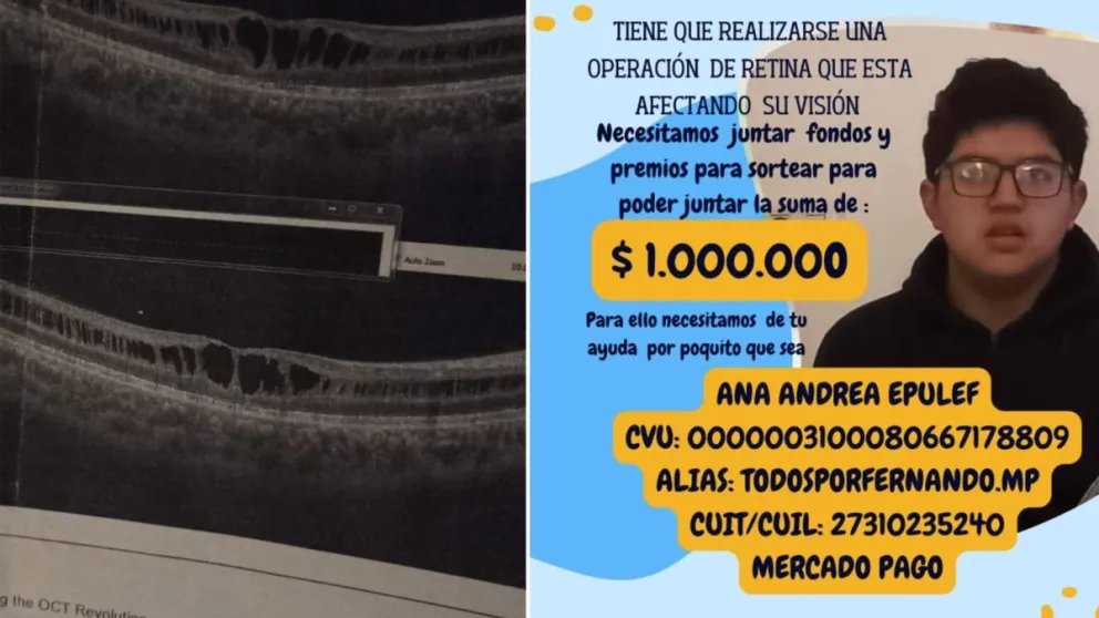 Fernando necesita la colaboración de los roquenses para no perder su visión