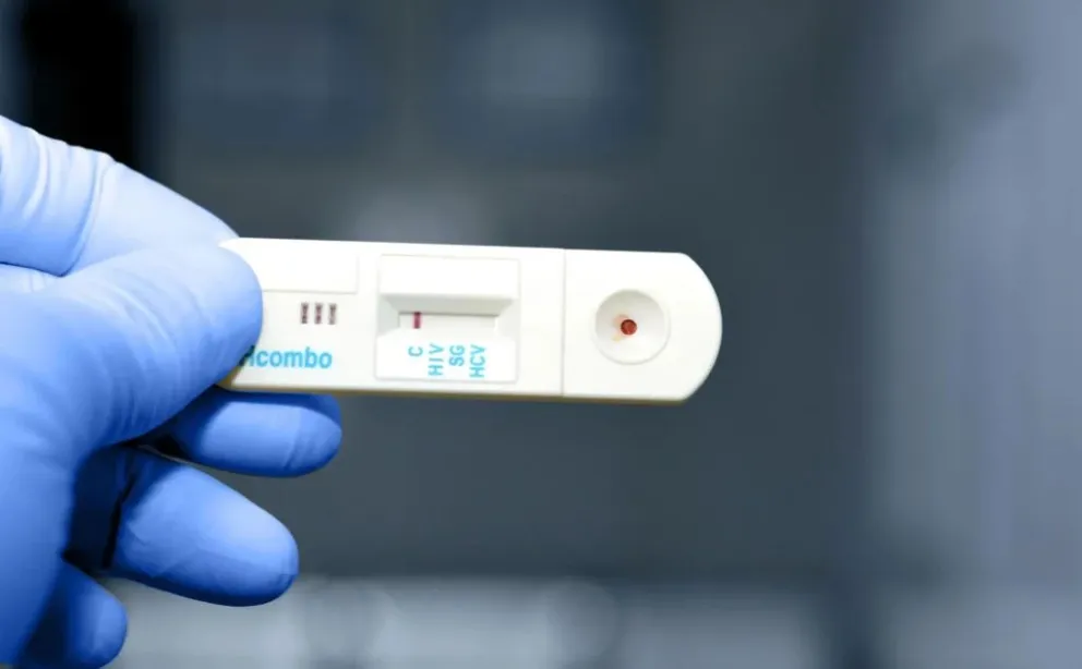 Preocupa el aumento de infecciones de transmisión sexual: “El motivo es que no se usa el preservativo”
