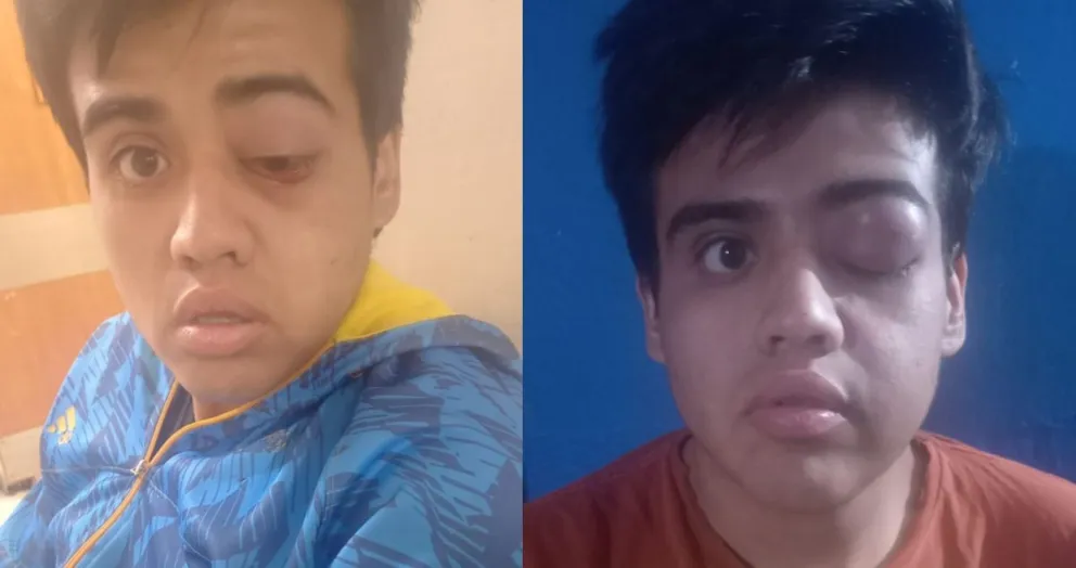 Lo atacaron en el barrio, podría perder la visión de un ojo: necesita ayuda de la comunidad