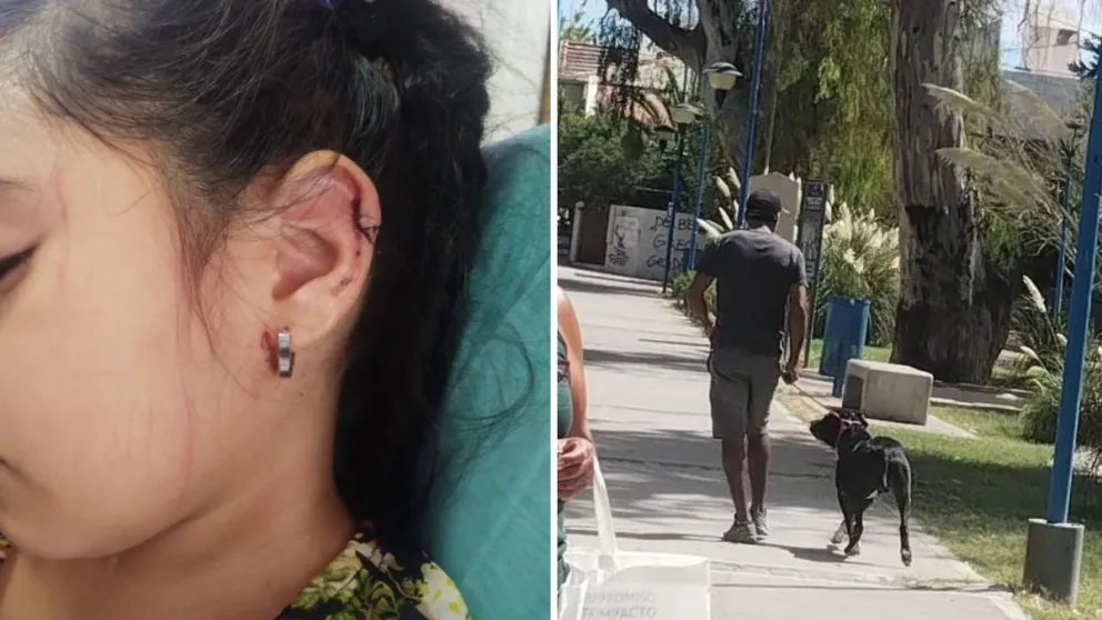 La nena de cuatro años que terminó con tres puntos de sutura en la oreja. (Foto gentileza)