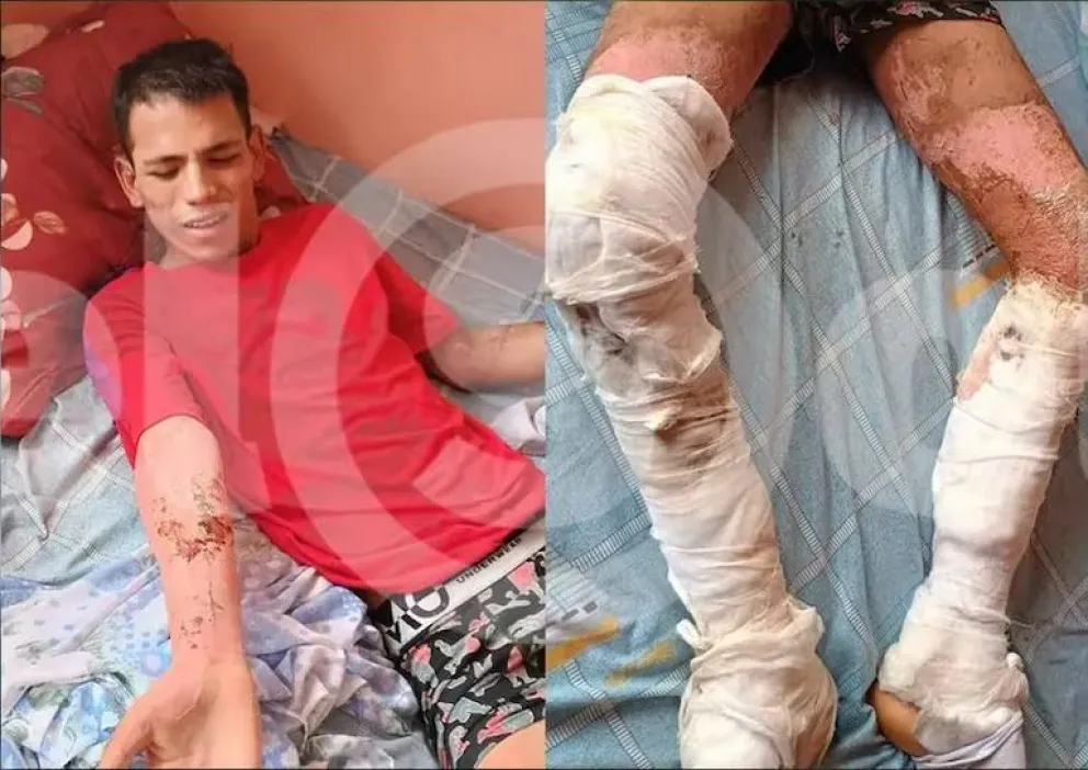 Una vez que reciba el alta médica, será trasladado a una cárcel común.