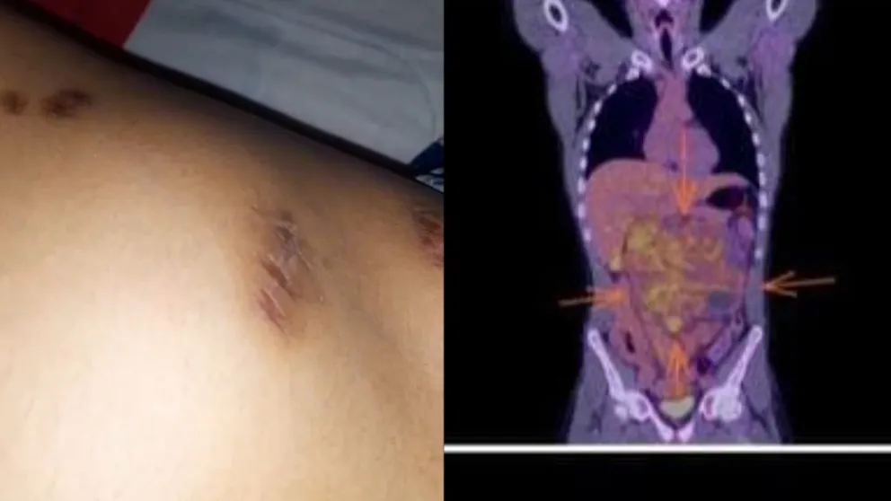 Lautaro y su familia están recaudando fondos para cubrir los gastos de viáticos, comida y traslado. (Foto gentileza)