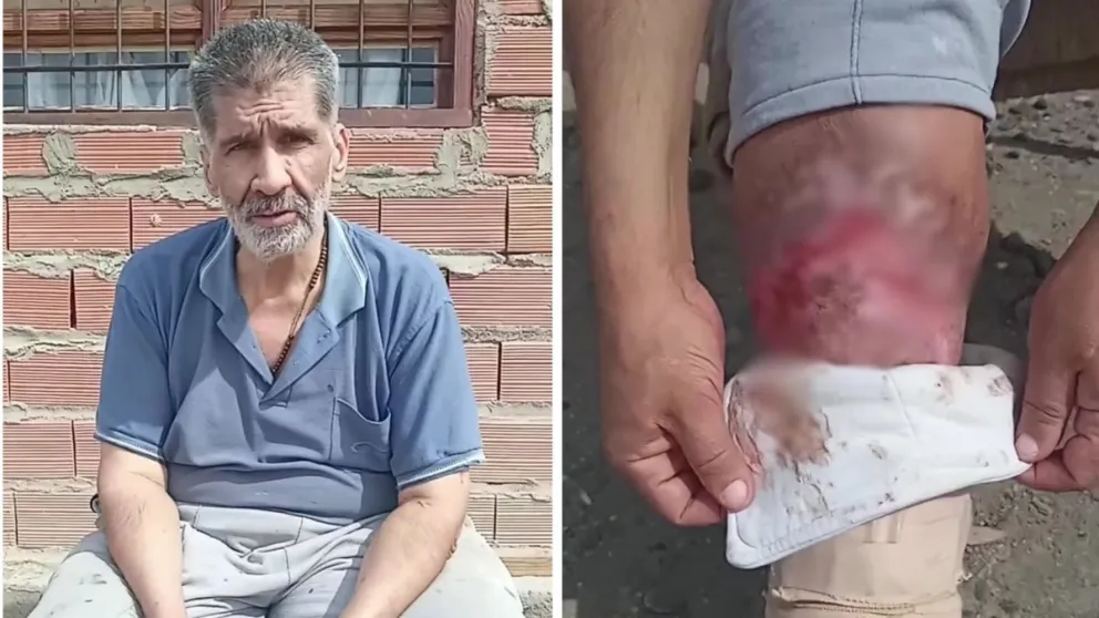 El costo del tratamiento es de 4 millones de pesos, una cifra que no puede afrontar por sí solo. (Foto ANRoca)