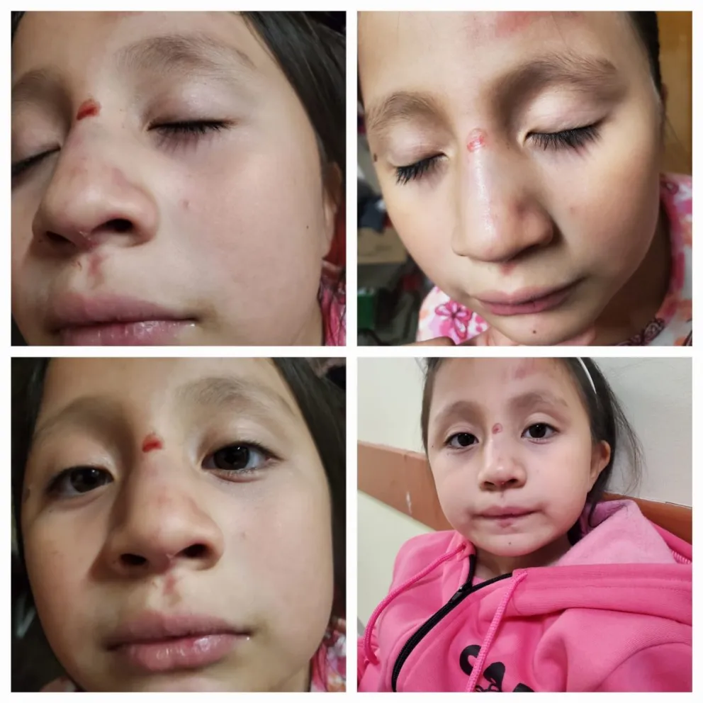 La familia  esta ahora enfocada en la salud de la niña. 