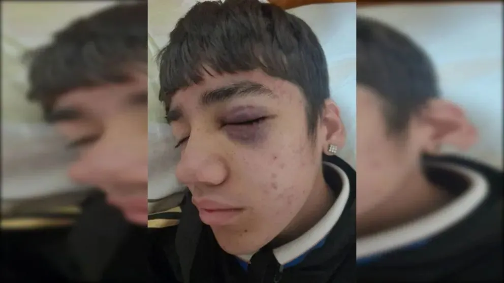 La mamá de la víctima anunció que realizará una denuncia penal para que el hecho no quede en el olvido. Foto (gentileza).