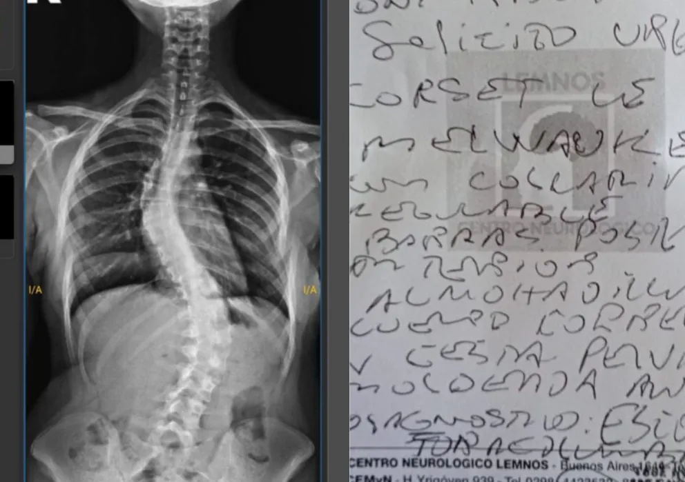 Por indicaciones médicas, la joven debe someterse a una cirugía. 