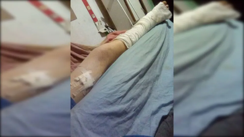 Una de sus piernas fue gravemente afectada. 