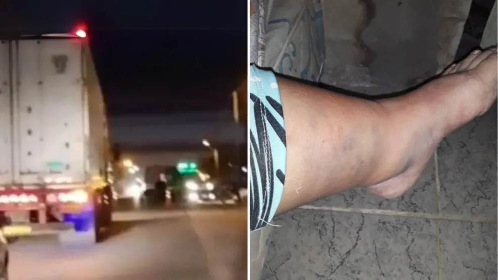 Vanesa quedó gravemente herida y a la espera de una operación más que urgente. (Foto gentileza)