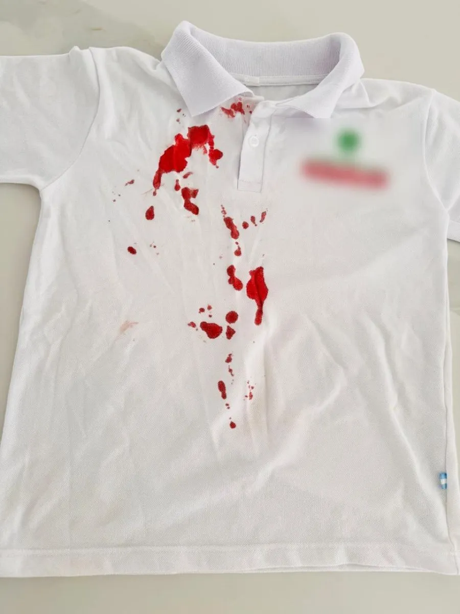 As&iacute; qued&oacute; la remera del estudiante atacado. Foto (gentileza)