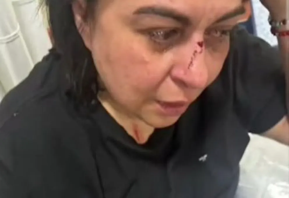 Vanina Lavaccara sufrió lesiones en el rostro y el brazo tras ser agredida en plena vía pública. La docente universitaria fue asistida por vecinos y atendida en un sanatorio local. Foto: gentileza