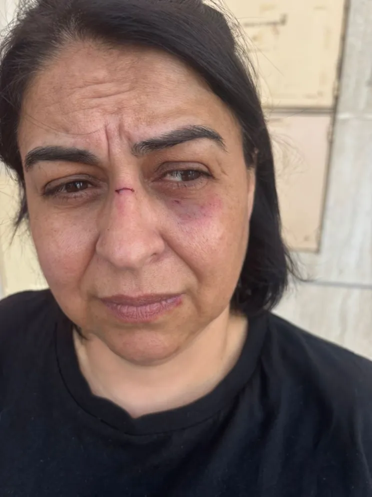 Vanina Lavacara, docente de la Universidad Nacional de Río Negro, resultó herida tras ser atacada en la vía pública. Foto: gentileza