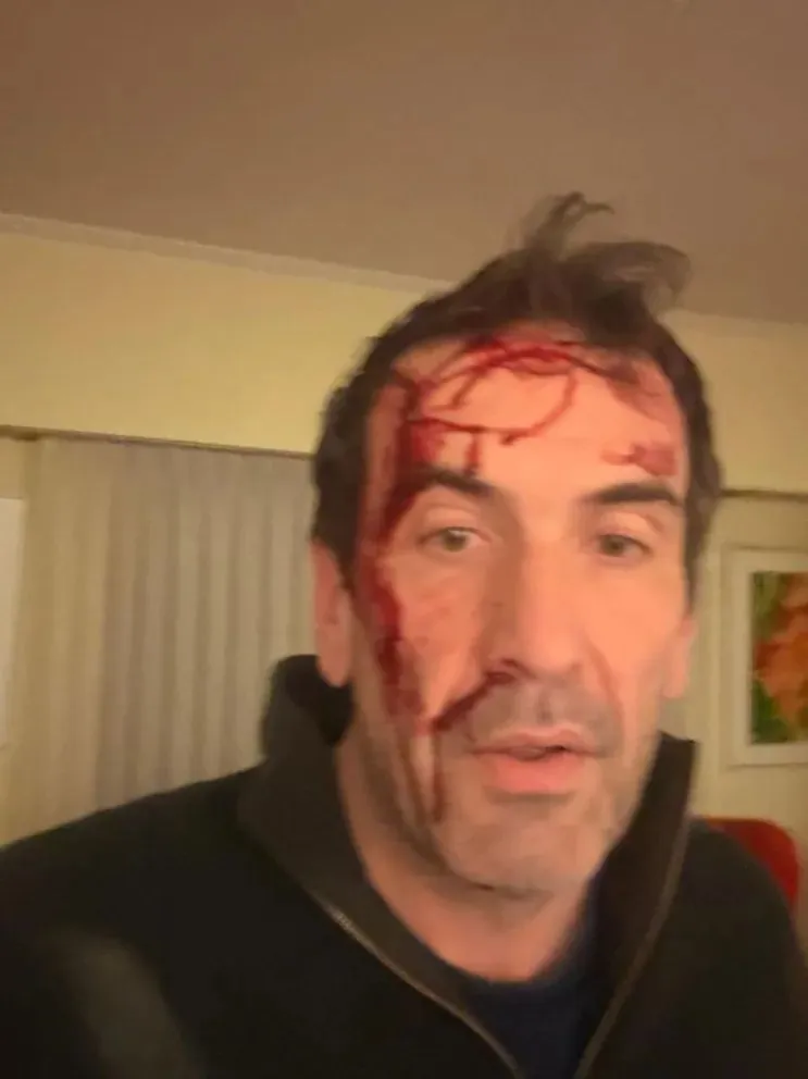 n episodio de violencia sacudió a la ciudad de Neuquén cuando Pablo Cervi, diputado nacional y candidato a senador por La Libertad Avanza, fue víctima de un asalto . Foto: redes