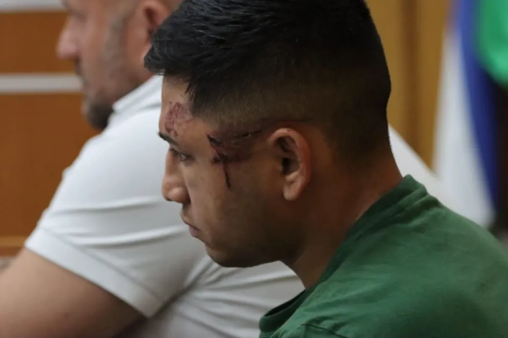 La fiscalía pidió que se realice un examen físico al único imputado, Axel Araneda (29), actualmente detenido con prisión preventiva, para verificar si presenta lesiones compatibles con un intento de auxiliar a las personas que viajaban en el otro vehículo