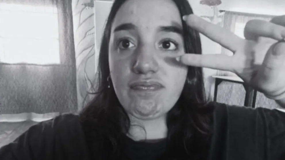 La joven de tan solo 17 años había logrado escapar del auto envuelto en llamas. (Foto gentileza)