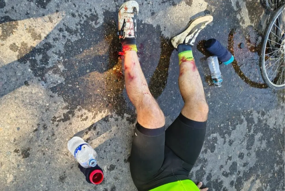 Un ciclista de Roca fue atacado por un grupo de entre 8 y 10 perros. 