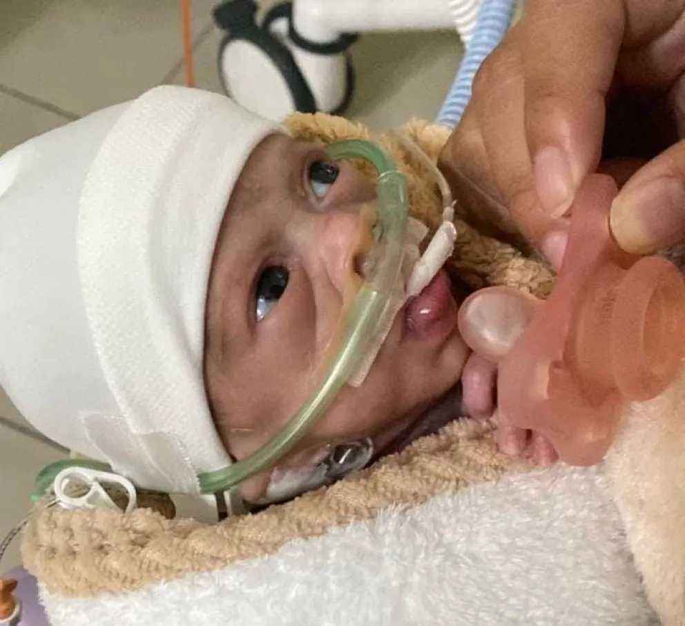 La pequeña Pía no se rinde y sus padres confían que saldrá adelante. Foto gentileza