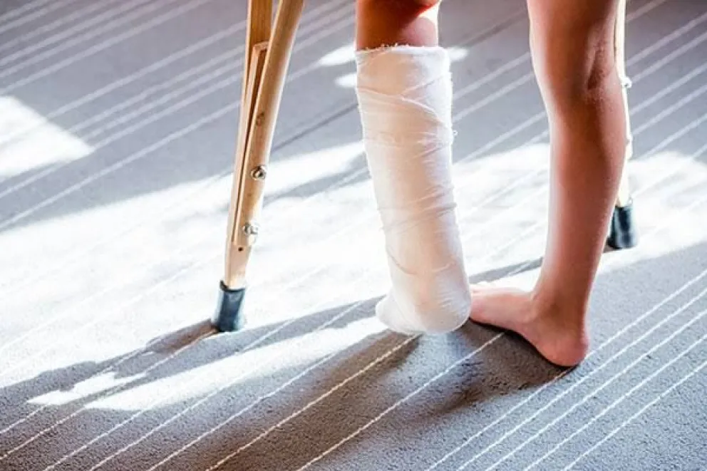 La joven sufrió una fractura en una de sus piernas. 