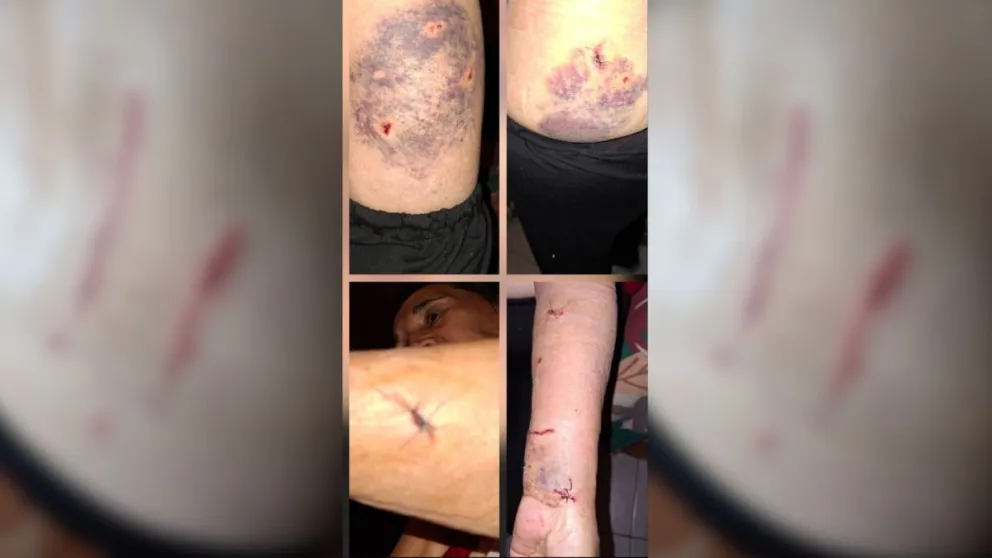 Las perras habrían atado más de cinco personas y los vecinos esperan que se adopte una medida antes de que ocurra un nuevo episodio. “Es muy peligroso, en el barrio es un peligro”, sostuvo la vecina en dialogo con ANR. Foto cortesía